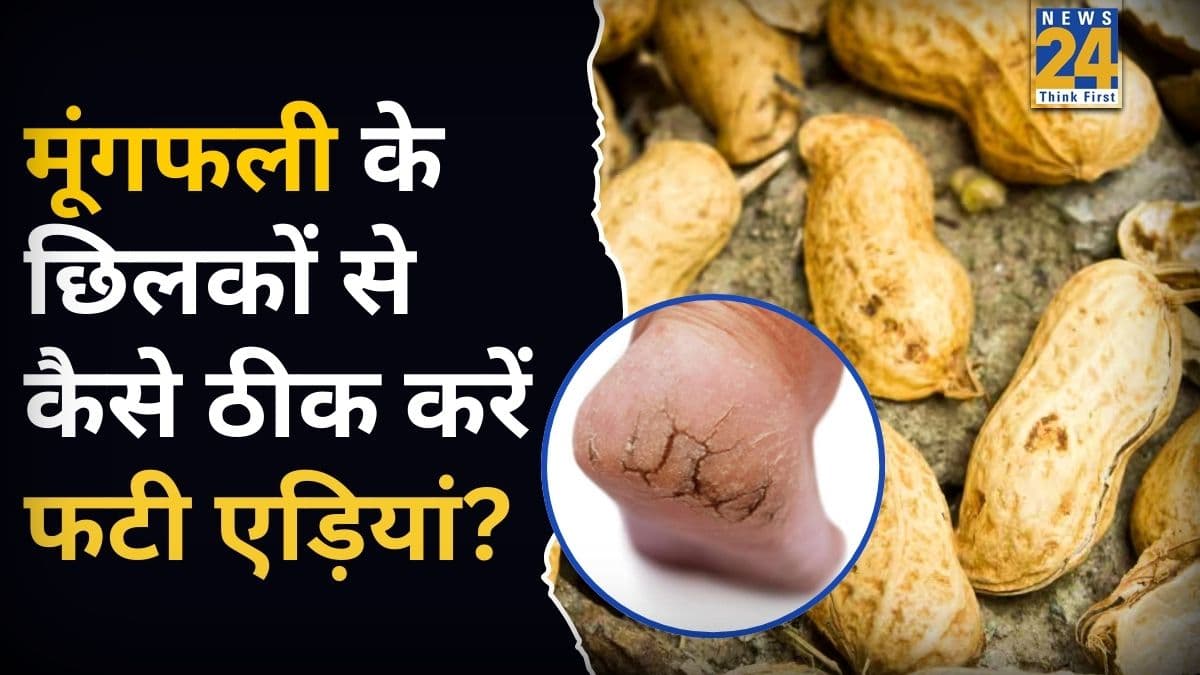 Cracked Heels Cream: मूंगफली के छिलके फेंके नहीं, यूं तैयार करें Foot Cream, फटी एड़ियां भी बन जाएंगी रुई जैसी कोमल