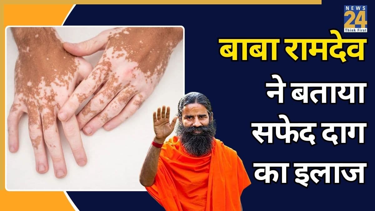 सफेद दाग को जल्दी कैसे ठीक करें? बाबा रामदेव ने बताए इलाज करने के 5 असरदार तरीके