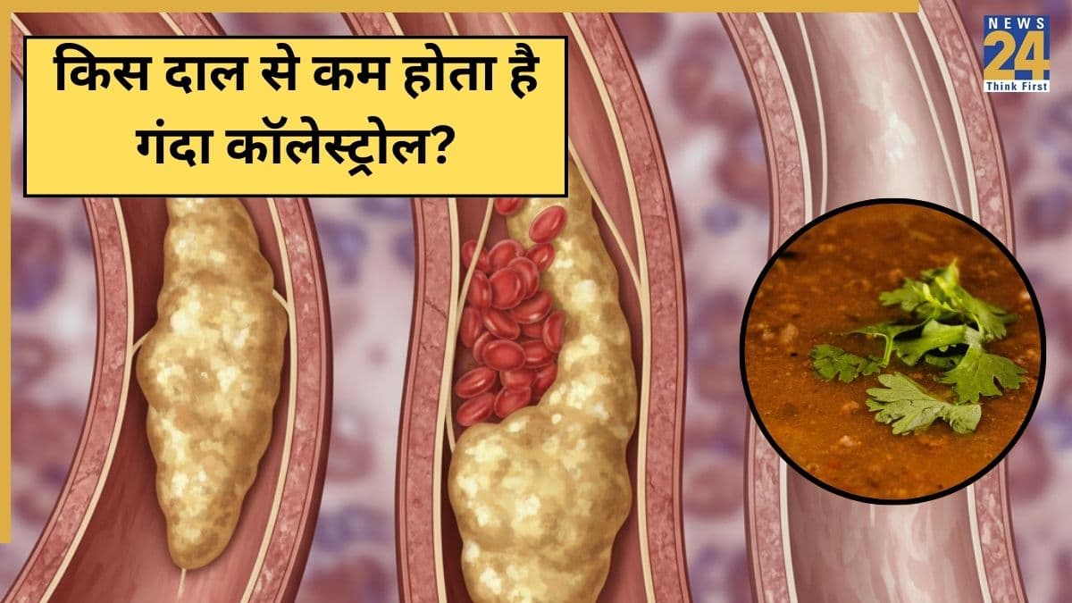 कोलेस्ट्रॉल बढ़ने पर कौन सी दाल खानी चाहिए? यहां जानिए कोलेस्ट्रॉल कम करने के लिए कौन सी दाल सबसे अच्छी है