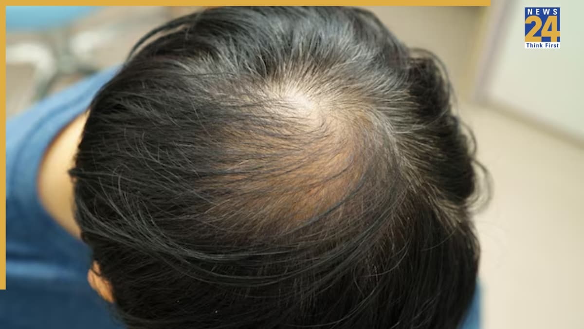 सिर पर चक्र बनना शुभ है या अशुभ? जानें भंवर को लेकर क्या कहता है सामुद्रिक शास्त्र