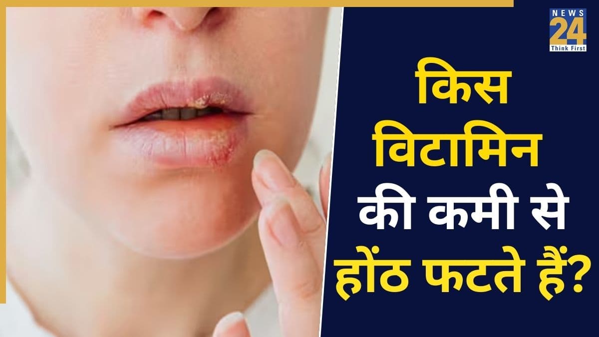 किसकी कमी से होंठ फटते हैं? यहां जानिए लिप्स किस Vitamin Deficiency का देते हैं संकेत