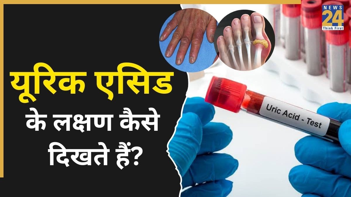 यूरिक एसिड बढ़ने की पहचान क्या है? पेशाब से लेकर पैरों तक में दिखते हैं Uric Acid बढ़ने के 7 लक्षण