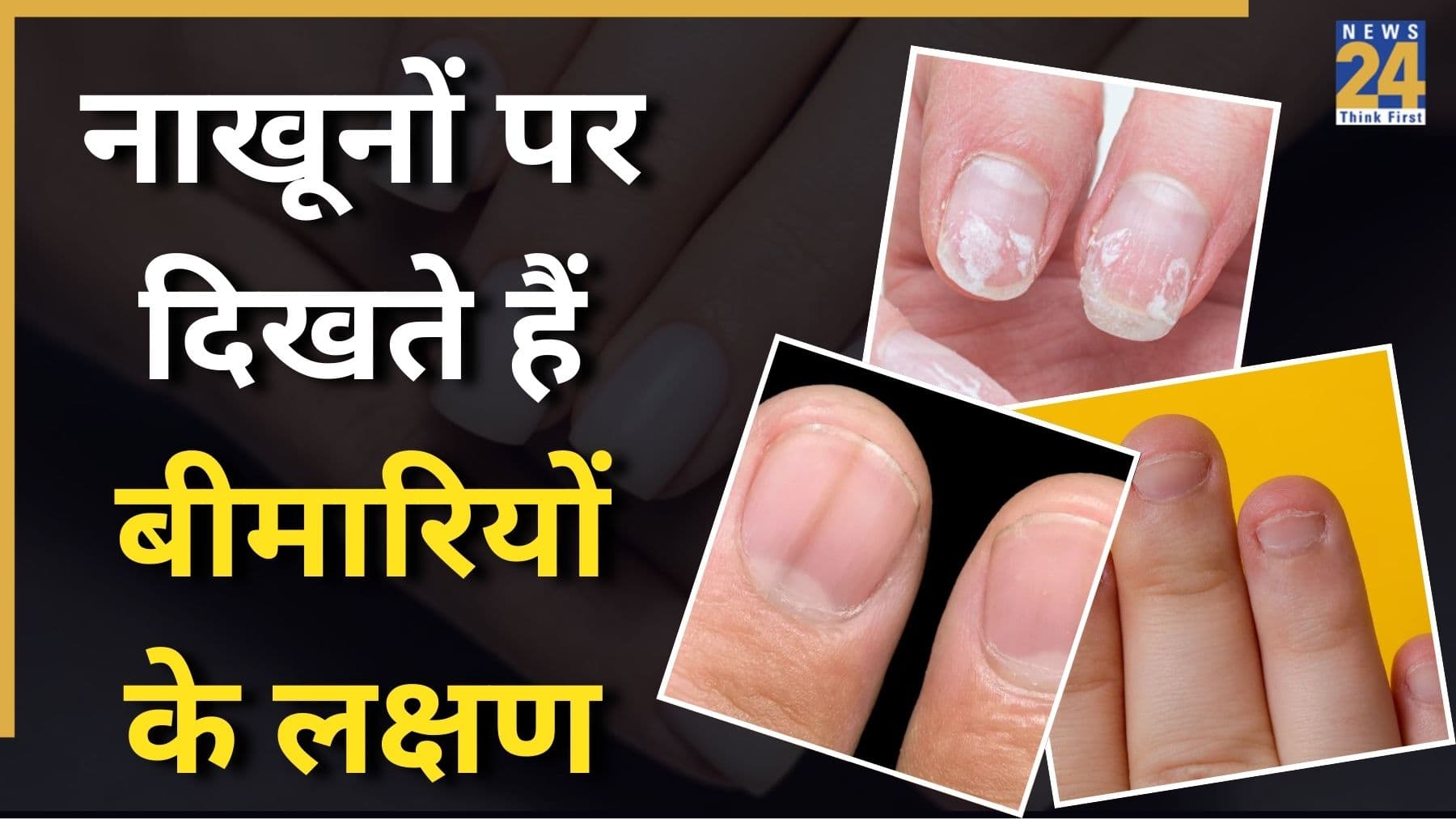 नाखूनों पर दिखते हैं डायबिटीज, थायराइड और फेफड़ों की दिक्कत के लक्षण, इन 8 संकेतों को कभी ना करें इग्नोर