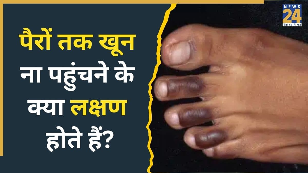 पैरों में खराब ब्लड सर्कुलेशन के क्या लक्षण हैं? डॉक्टर ने बताया आर्टरीज ब्लॉक होने पर दिखते हैं ये 4 Symptoms