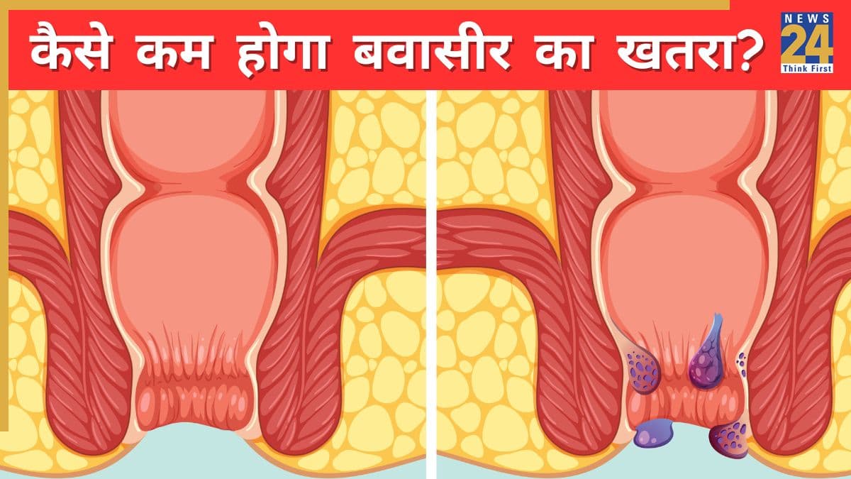 छोटी-छोटी आदतें बन सकती हैं बवासीर की वजह, डॉक्टर ने कहा Piles से बचना है तो रोजाना करें ये 5 काम