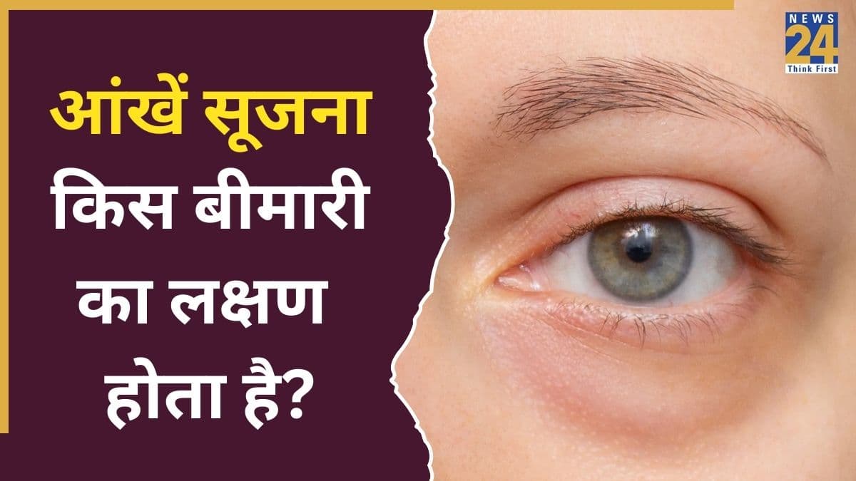 आंखों का सूजना किस बीमारी का लक्षण है? यहां जानिए किन दिक्कतों में फूली दिखती हैं आंखें