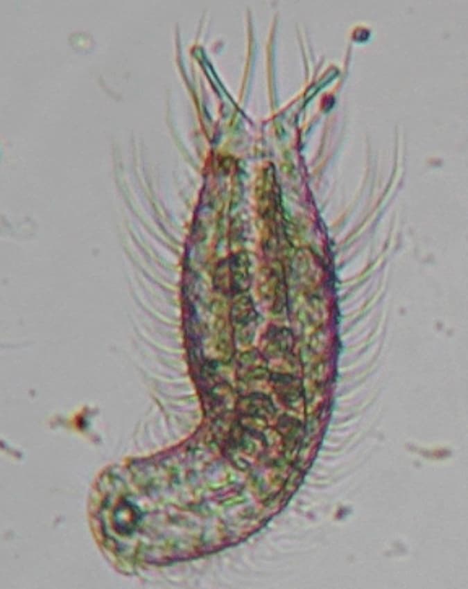 गैस्ट्रोट्रिच (Gastrotrich)
