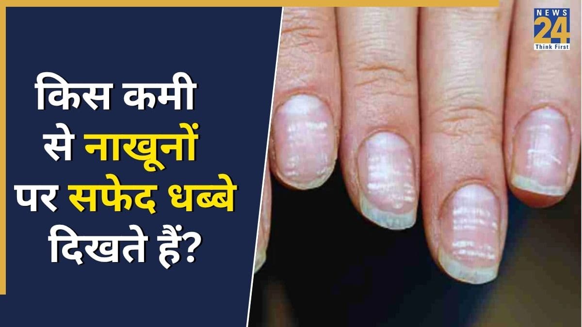 नाखूनों पर सफेद धब्बे किस कमी की वजह से होते हैं? यहां जानिए कैसे दूर होगी दिक्कत