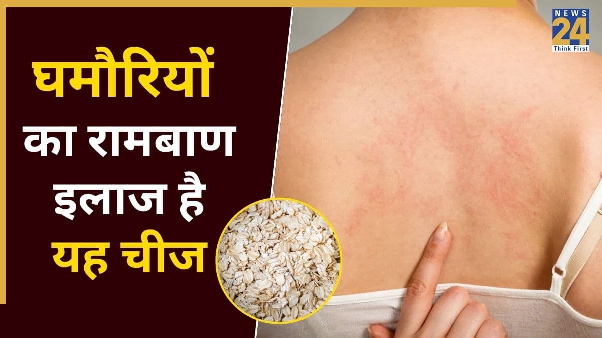 घमौरियों के दानों से घिर गई है पीठ, तो यहां जानिए क्या लगाने पर दूर हो जाएंगी Prickly Heat