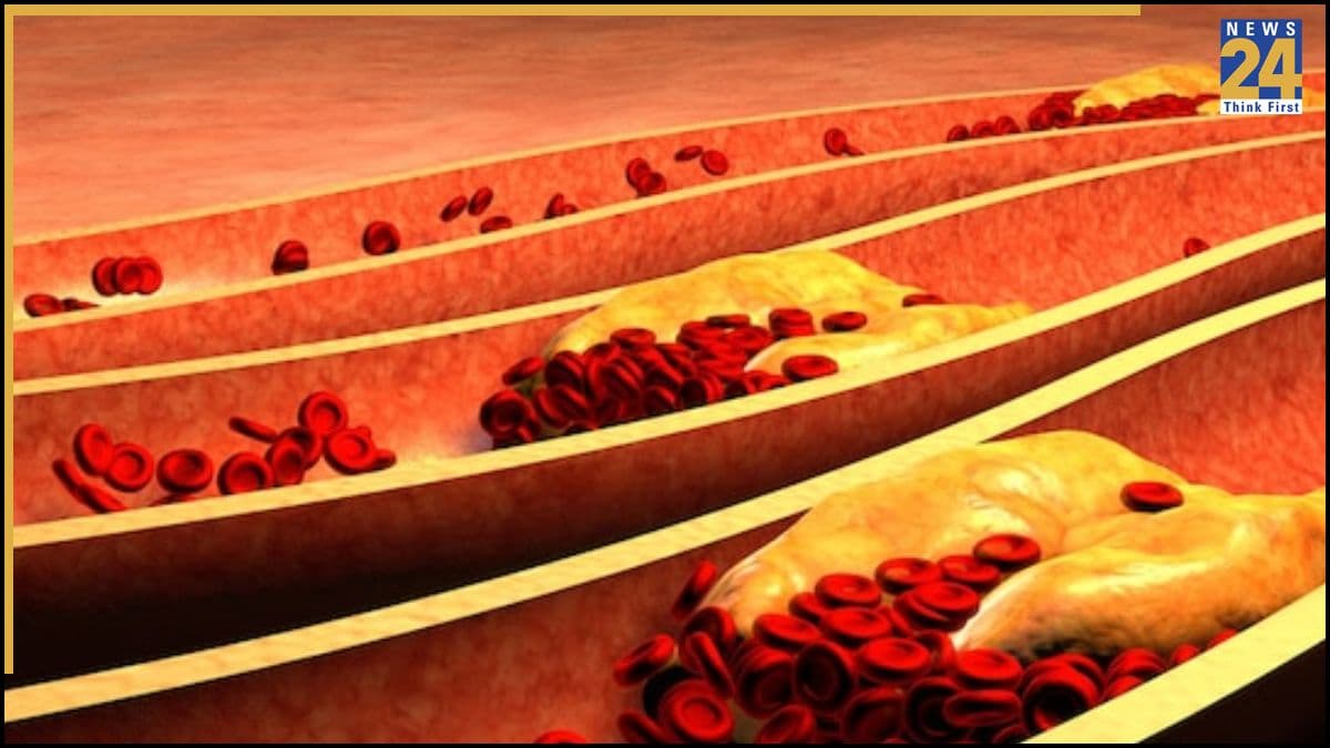 Arjuna Bark Benefits: नसों की गंदगी साफ करने के लिए खाली पेट पिएं यह पानी, सिर्फ 2 महीने में दिखने लगेगा असर