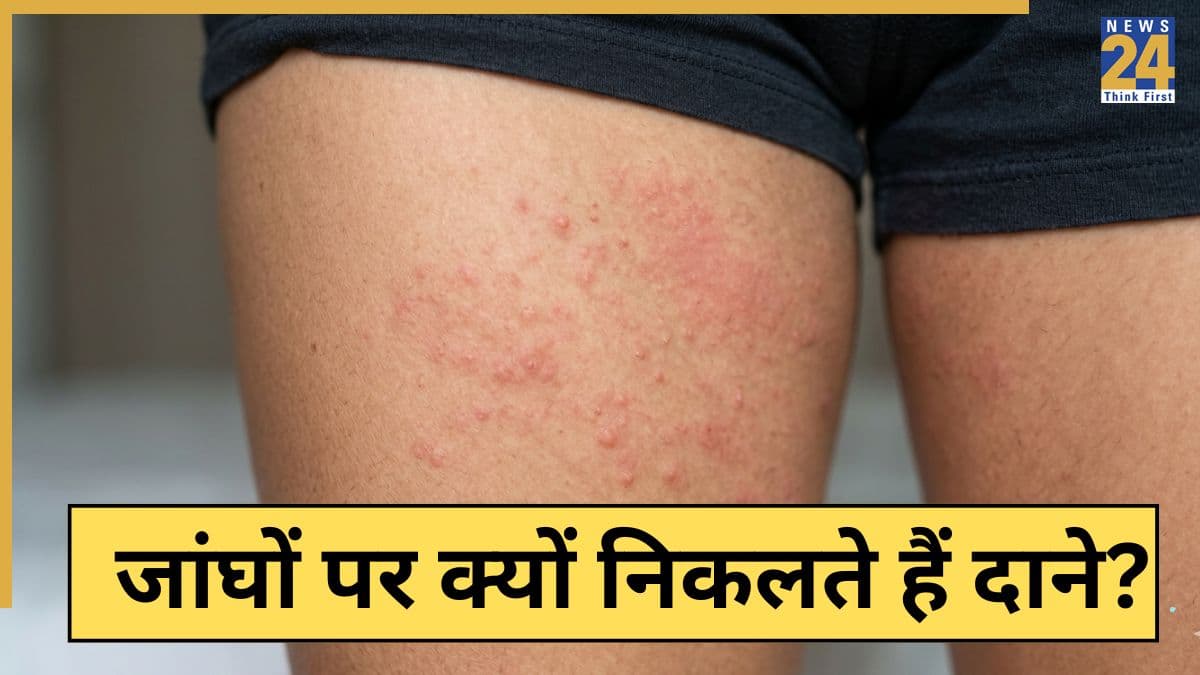 Rash And Bumps On Inner Thigh