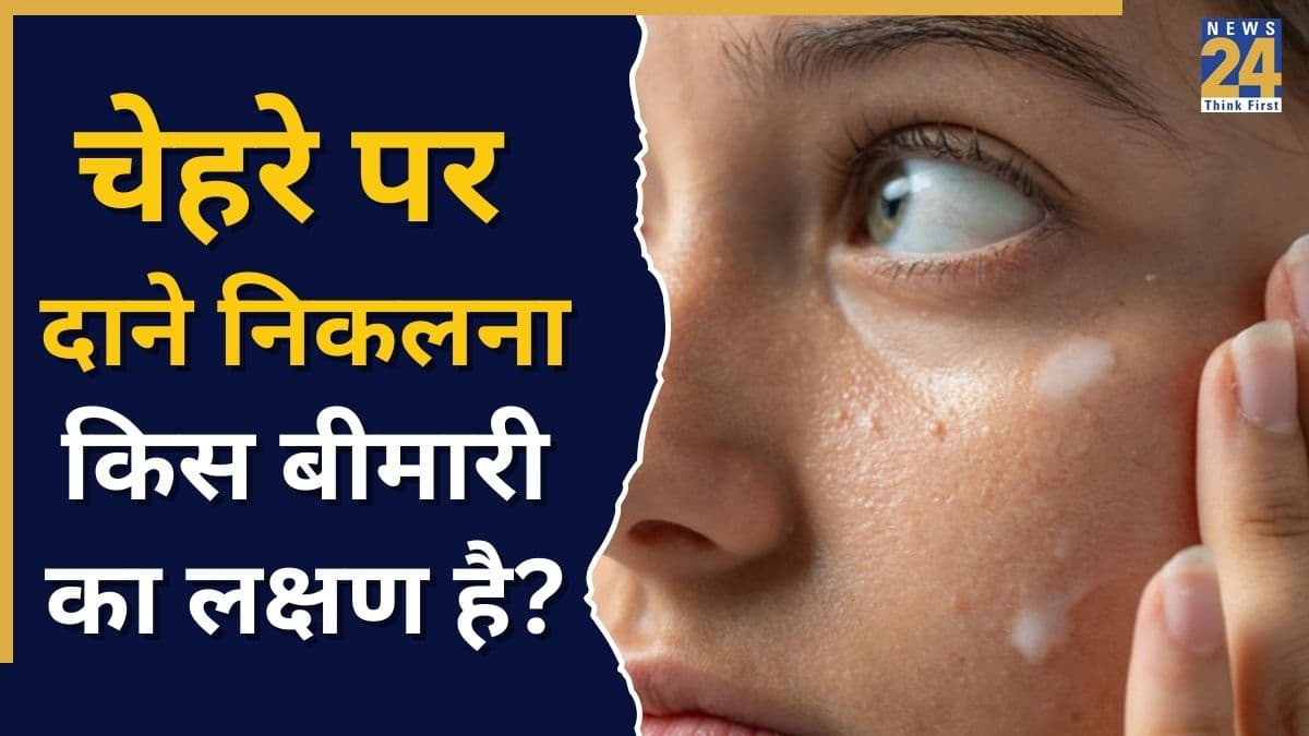 फेस पर अचानक दाने निकलने का क्या कारण होता है? यहां जानिए क्यों नजर आते हैं ये छोटे सफेद बंप्स