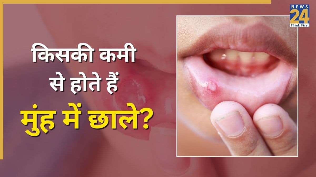 छाले किसकी कमी से होते हैं? डॉक्टर ने बताया सिर्फ जैल लगाने से नहीं जाएगी यह दिक्कत