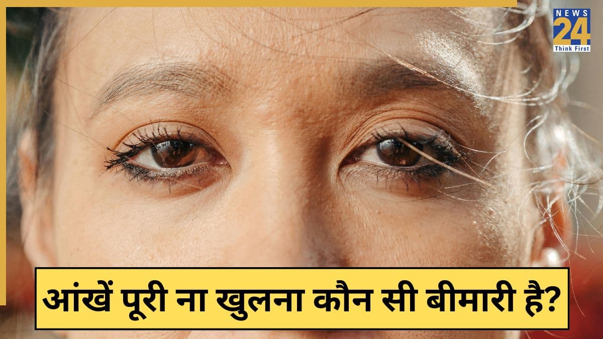 आंखों का पूरी तरह ना खुलना कौन सी बीमारी है? जानिए कैसे पहचानें इसके शुरुआती लक्षण