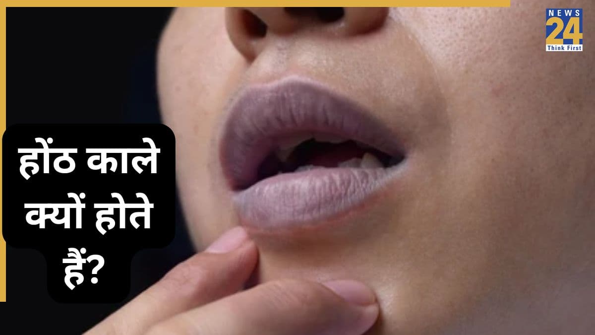 Vitamin Deficiency Lips Turning Black