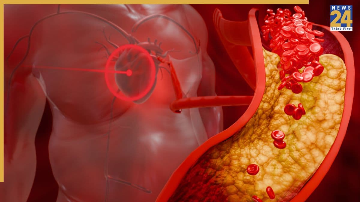 Cholesterol Increase Causes