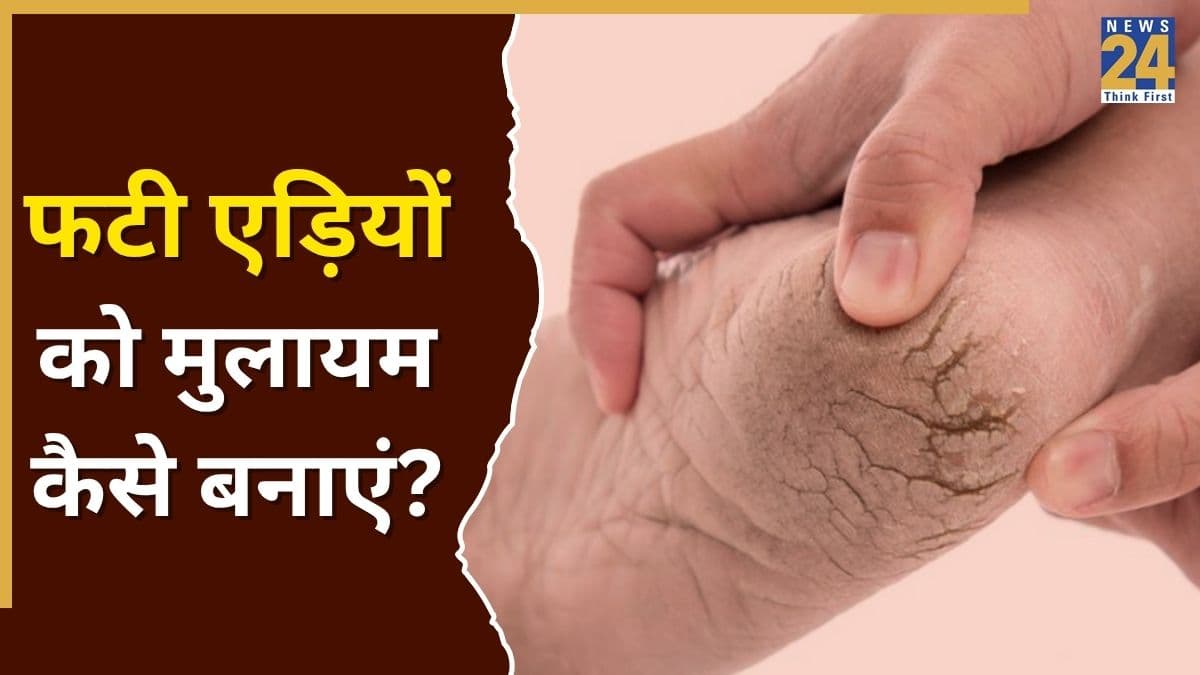 फटी एड़ी के लिए कौन सा घरेलू उपाय सबसे अच्छा है? रसोई में रखी ये चीजें दिखाएंगी असर