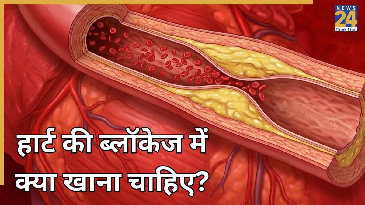 हार्ट ब्लॉकेज का सबसे अच्छा इलाज क्या है? जानिए Heart Blockage खोलने के लिए क्या खाना चाहिए