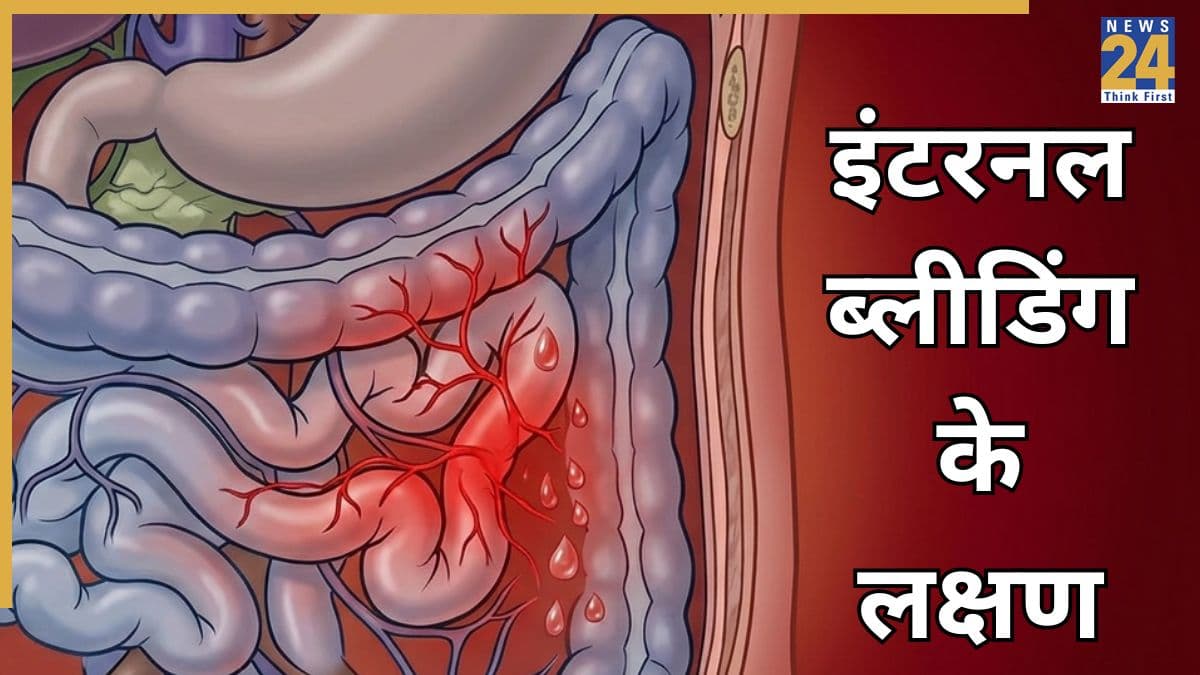 Internal Bleeding Symptoms And signs