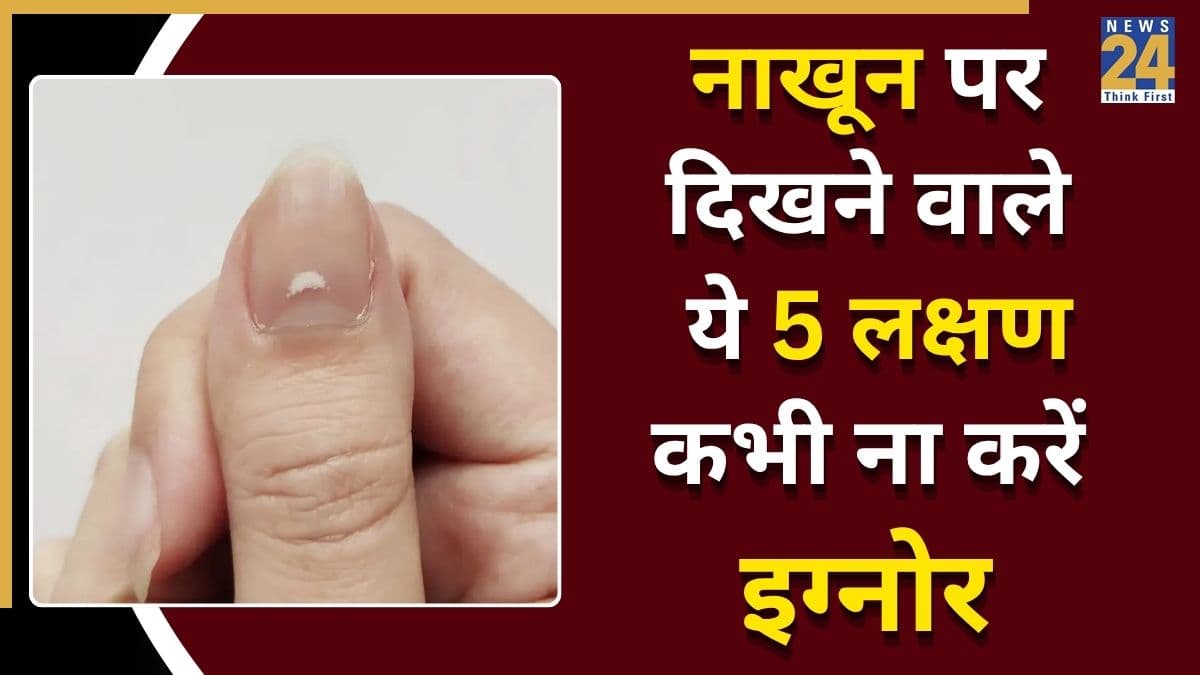 नाखूनों पर ये 5 निशान देते हैं शरीर में पोषक तत्वों की कमी का संकेत, डॉक्टर ने कहा कभी ना करें इग्नोर