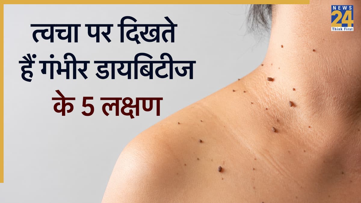 डायबिटीज कंट्रोल से बाहर होने पर त्वचा पर नजर आते हैं ये 5 लक्षण, पहचानने में ना करें गलती