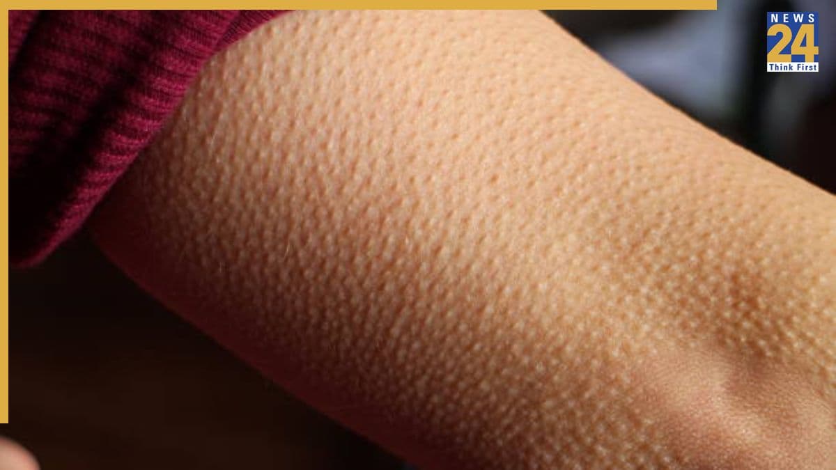 Why do we get goosebumps