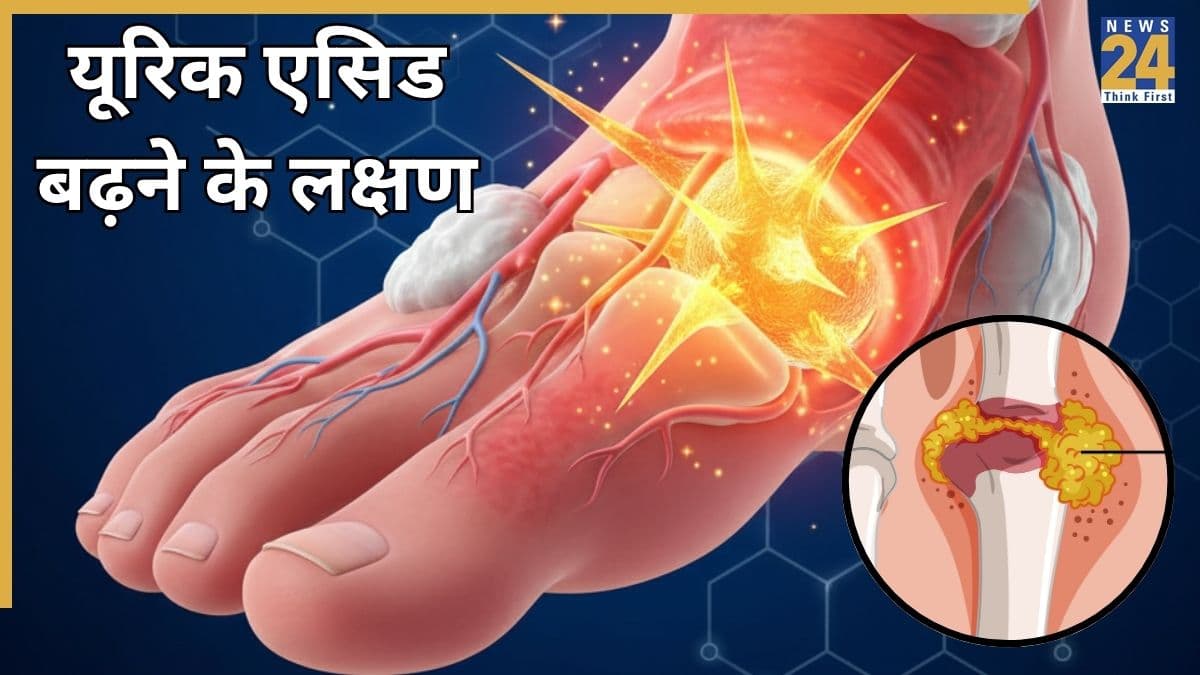 यूरिक एसिड बढ़ने से शरीर में क्या परेशानी होती है? जानिए High Uric Acid के लक्षण