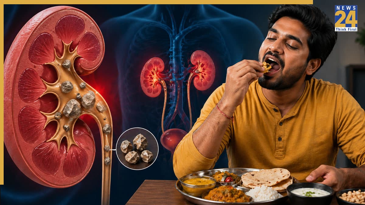क्या आप भी खाते हैं ये 5 चीजें? बन सकता है किडनी स्टोन का कारण!
