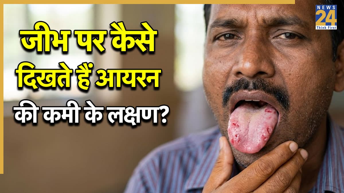 जीभ पर दिखते हैं आयरन की कमी के लक्षण, जानिए Iron को बढ़ाने के लिए क्या खाना चाहिए