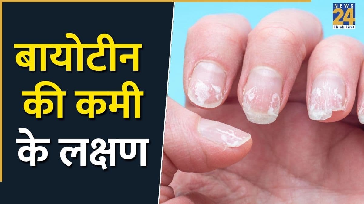 नाखूनों से पहचानी जा सकती है बायोटीन की कमी, जानिए शरीर में दिखते हैं कौन-कौन से लक्षण