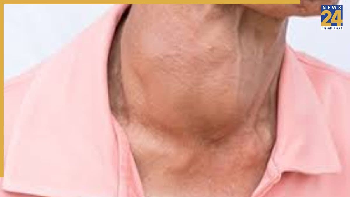 गले में टीबी के लक्षण कैसे महसूस होते हैं? जानिए इसके 10 बड़े संकेत