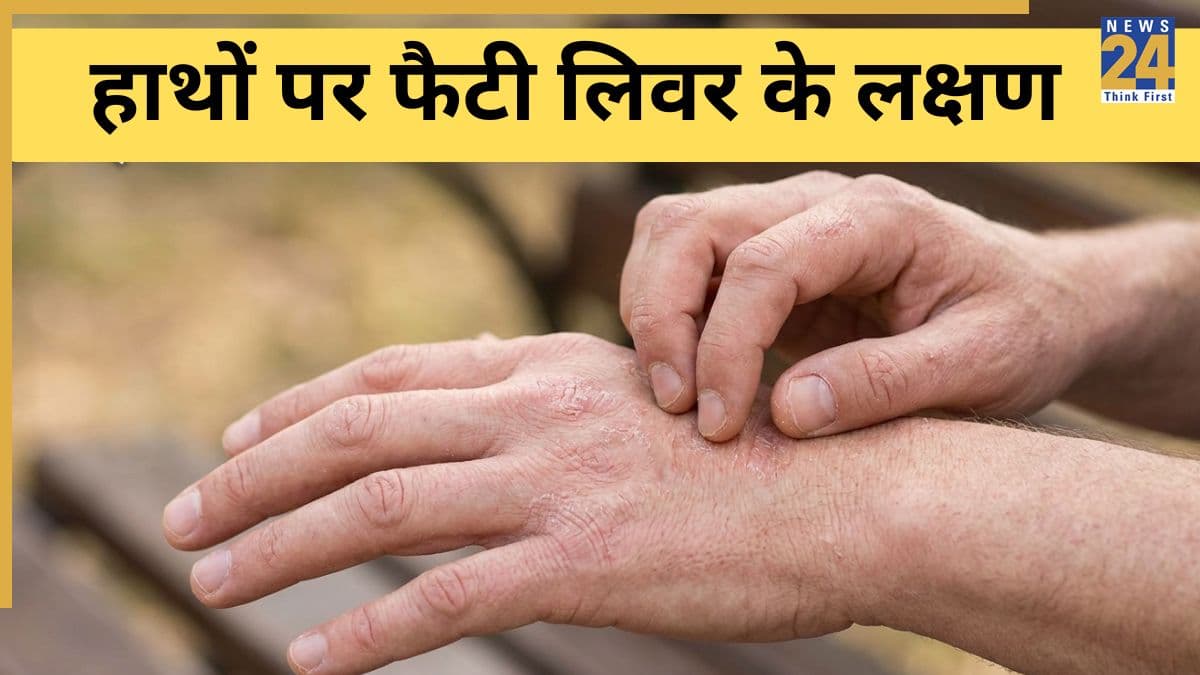 हाथों पर नजर आ सकते हैं फैटी लिवर के ये 5 लक्षण, आज करेंगे इग्नोर तो कल पड़ सकता है पछताना