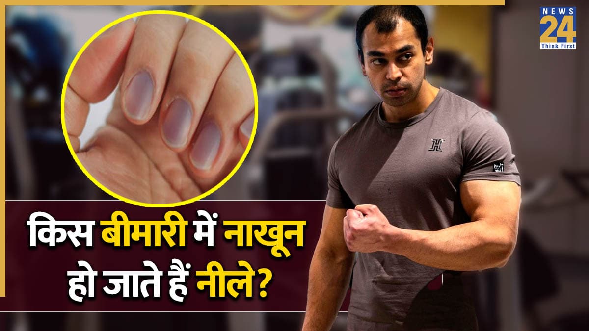 प्रतीक यादव की उंगलियों के नाखून पड़ गए थे नीले? जानिए ऐसा होना किन बीमारियों का हो सकता है संकेत