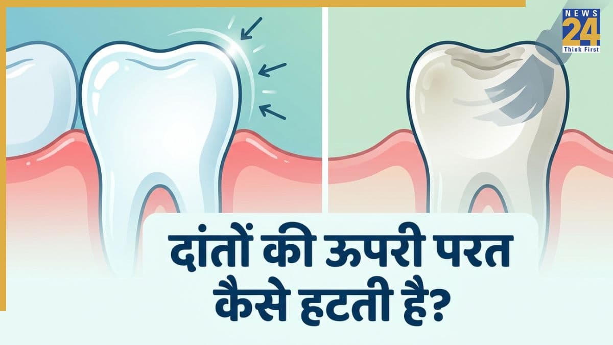 दांतों की ऊपरी परत क्यों जरूरी है? जानिए किन कारणों से हट जाता है Teeth Enamel