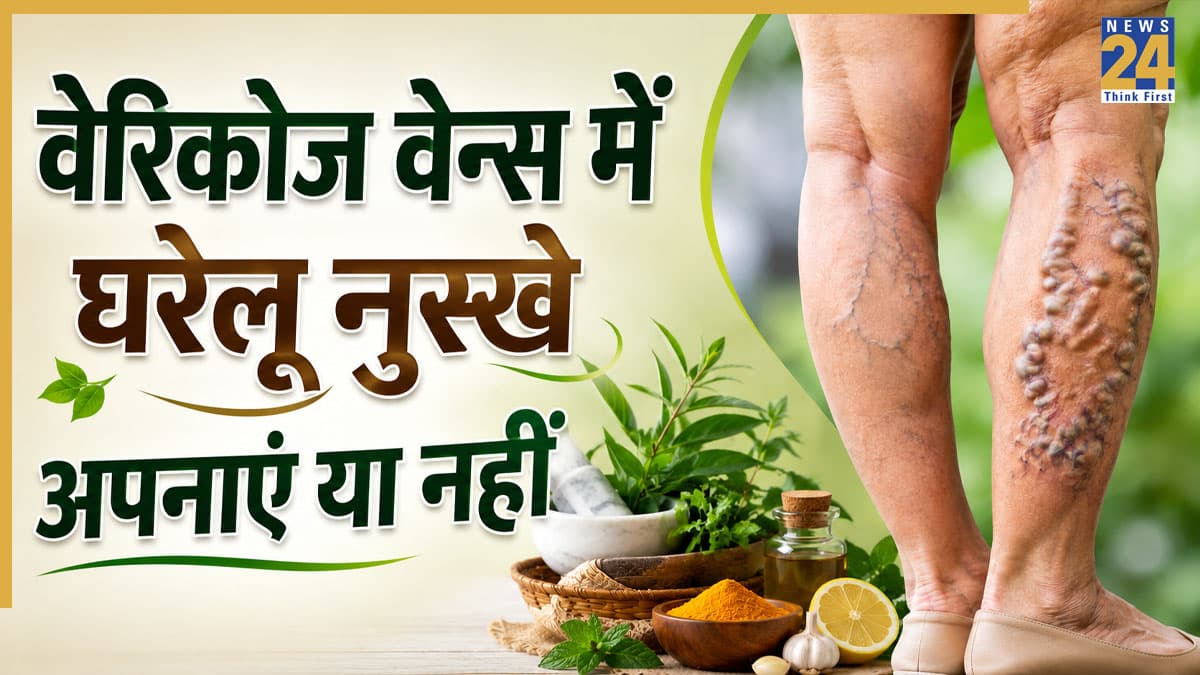 क्या घरेलू नुस्खों से ठीक हो सकती हैं वेरिकोज वेन्स? स्पेशलिस्ट ने दिया सटीक जवाब, बताया क्या और कितना है असरदार