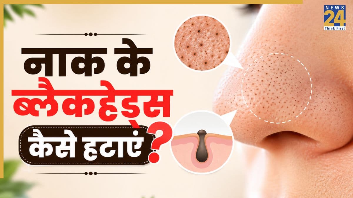 नाक से हटाने हैं ब्लैकहेड्स तो इस एक चीज को हफ्ते में 3 बार देख लीजिए लगाकर, दूर हो सकती है Blackheads की दिक्कत