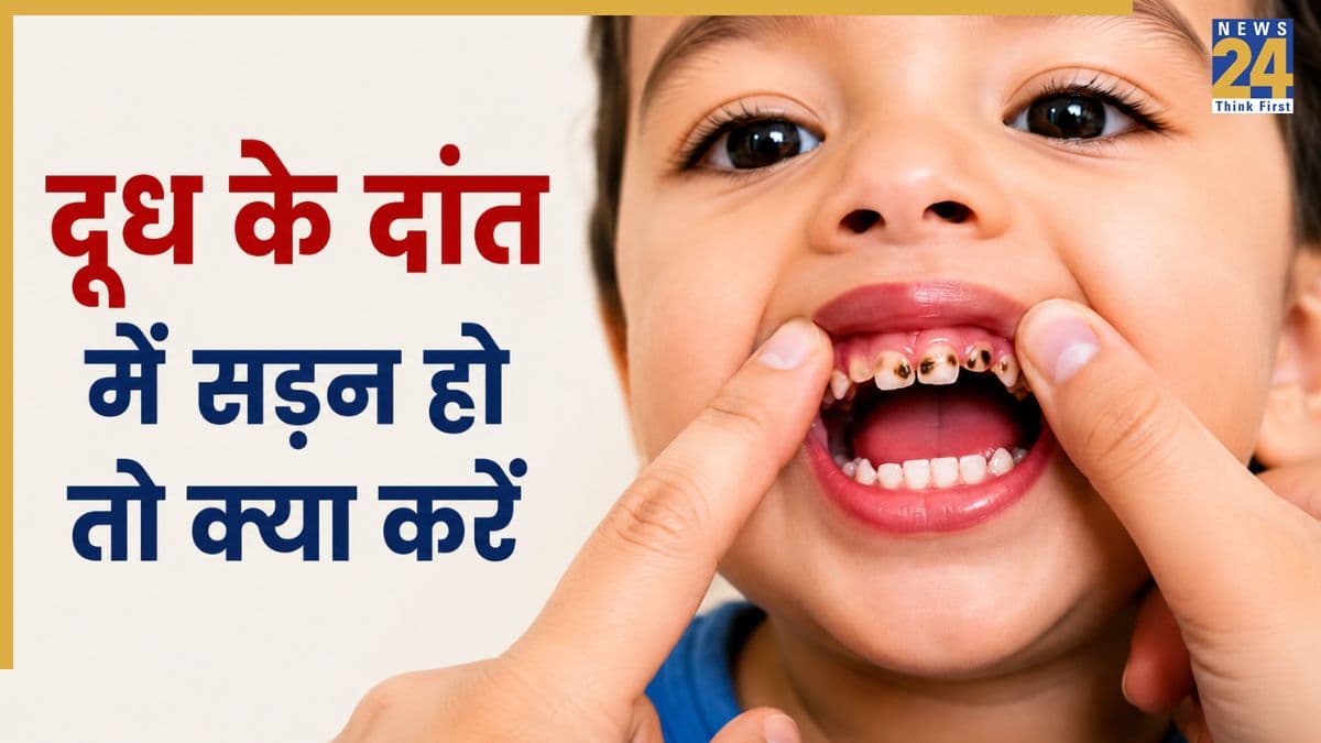 क्या दूध के दांत सड़ने पर परमानेंट दांत भी खराब हो जाते हैं? डॉक्टर ने बताया बच्चे के दांतों की कैसे करें देखरेख
