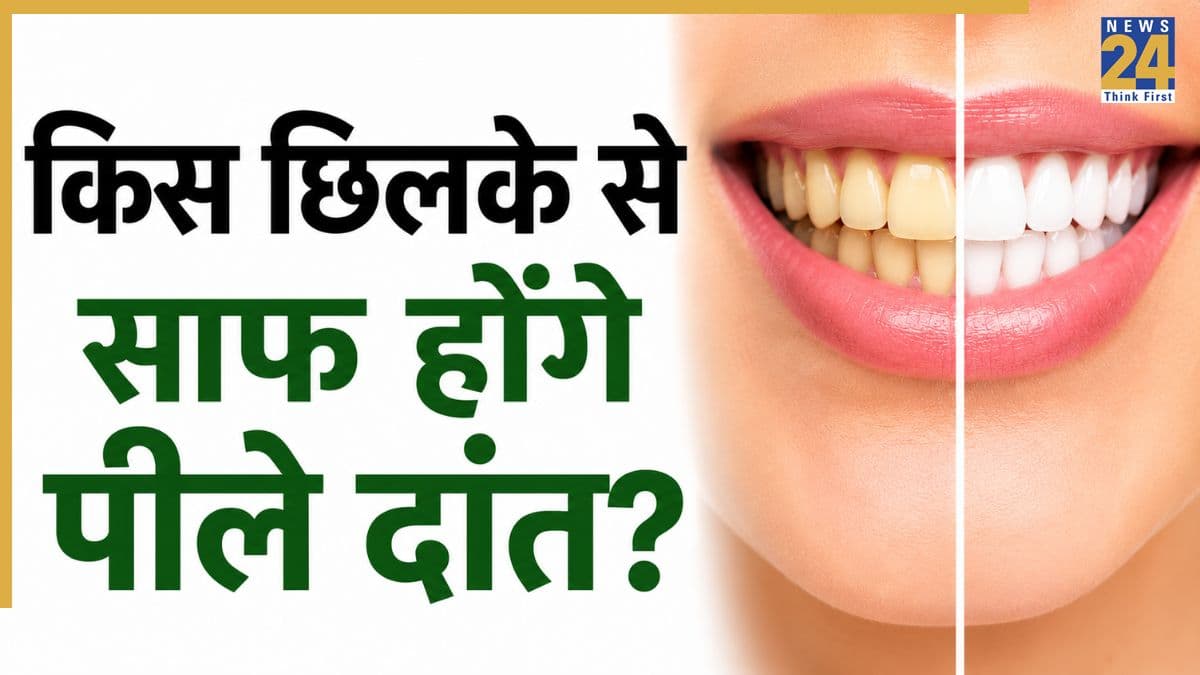 किस फल के छिलके से साफ हो सकते हैं पीले दांत? तुरंत जान लीजिए यह कमाल का नुस्खा