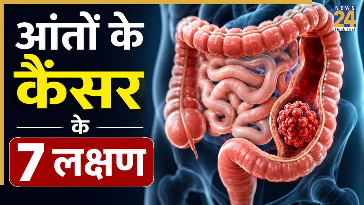 आंतों के कैंसर में दिखते हैं ये 7 लक्षण, गैस्ट्रोएंटेरोलॉजिस्ट ने बताया मल से मिलेंगे 3 सबसे बड़े संकेत