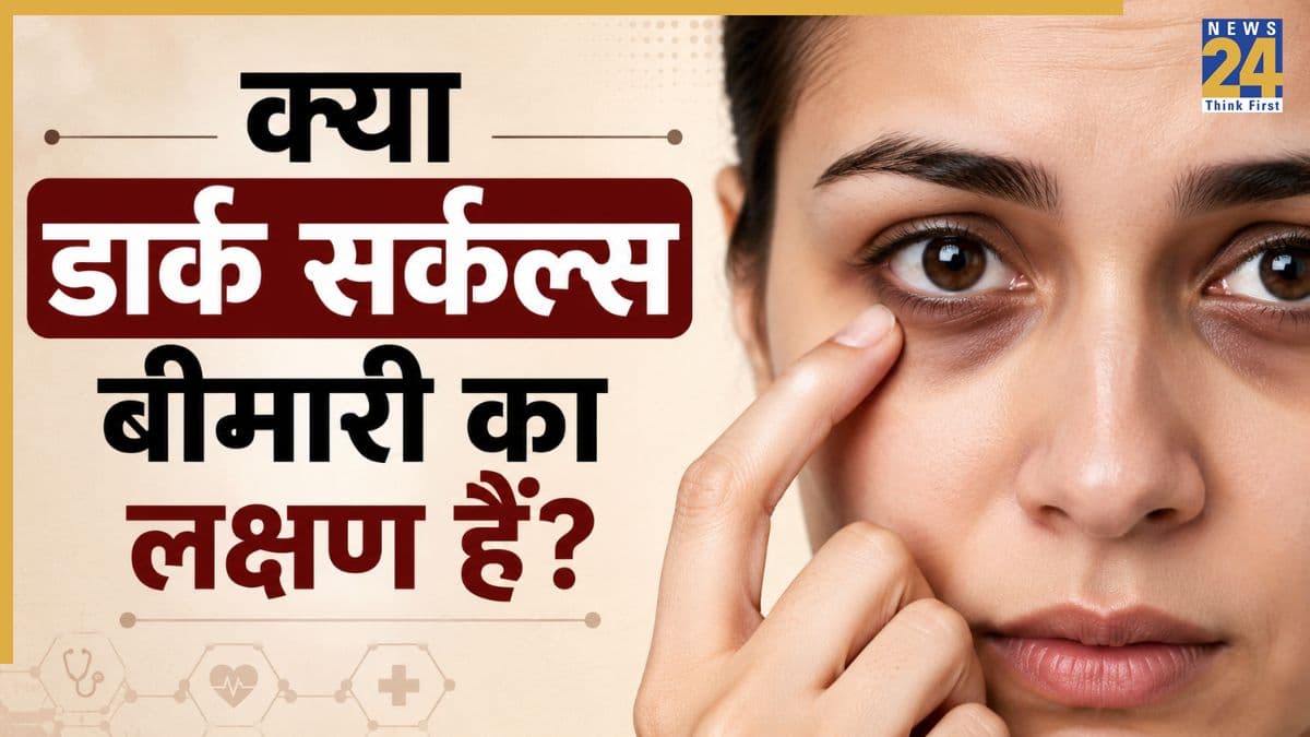 नींद की कमी नहीं बल्कि इन 7 कारणों से भी हो सकते हैं डार्क सर्कल्स, वजह चौंका देगी आपको