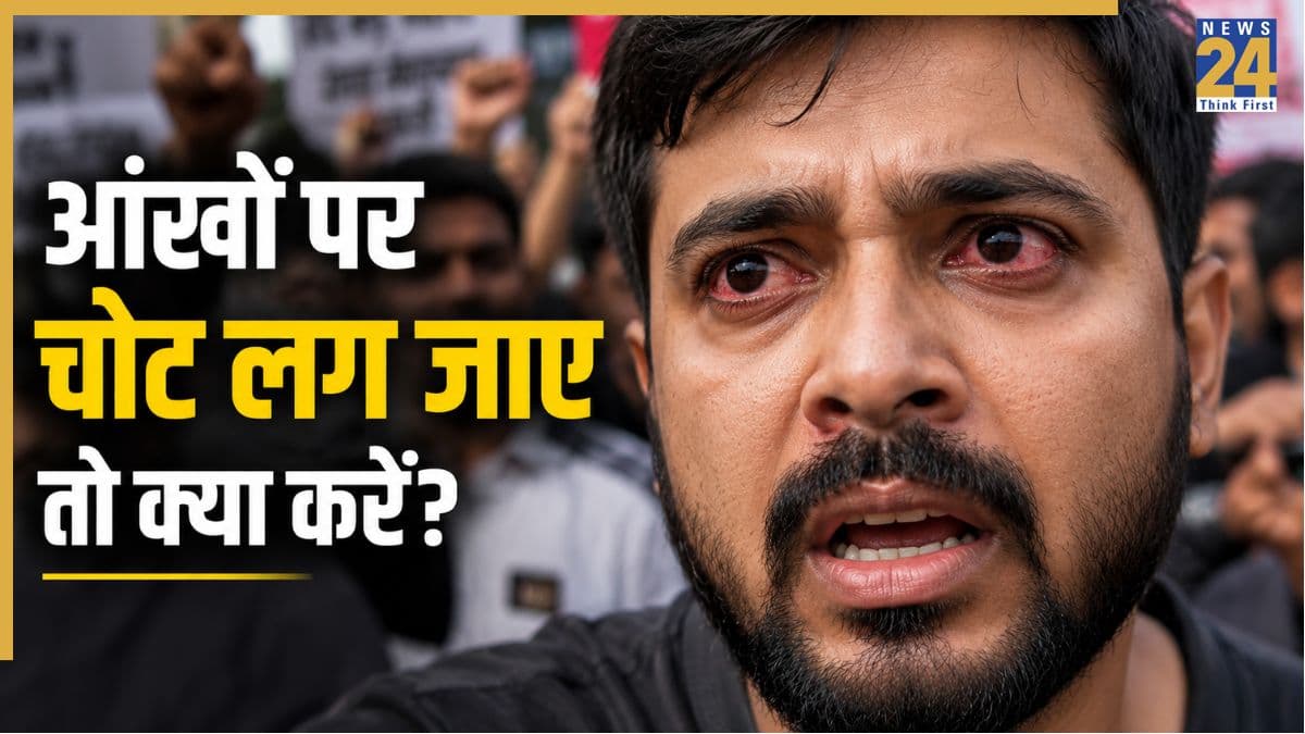 आंख पर डंडा या हाथ लग जाए तो तुरंत करें यह काम, डॉक्टर ने बताया आंखों की रोशनी बचाने का तरीका