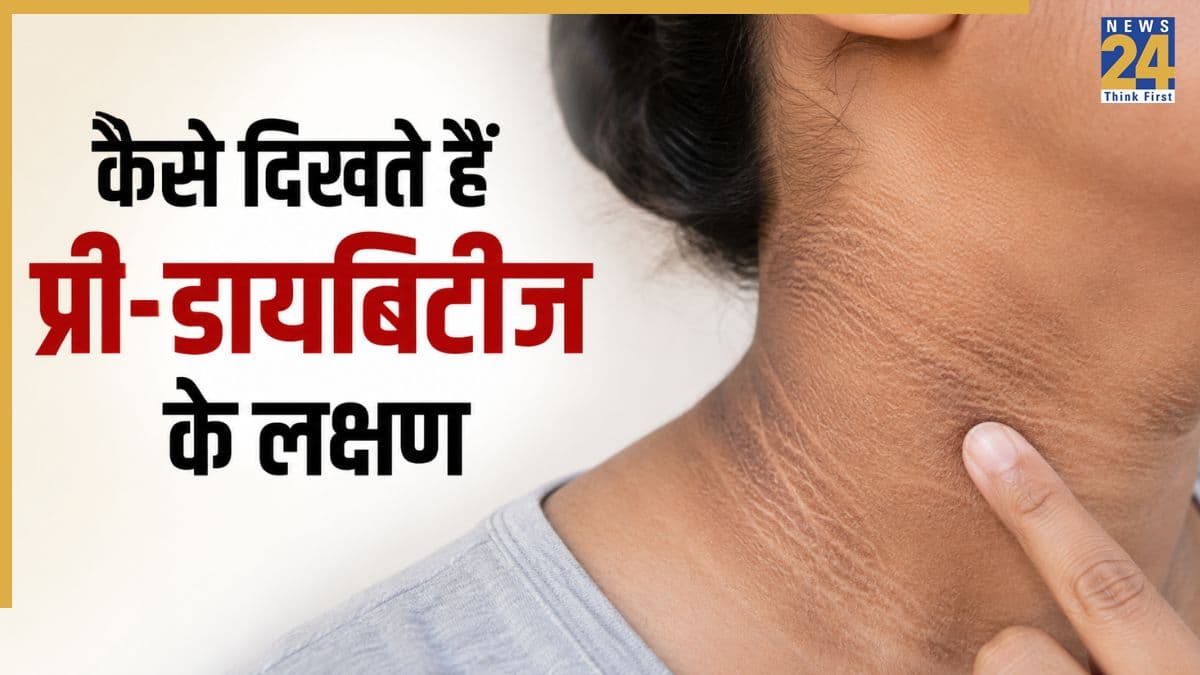 136000000 पहुंची प्री-डायबेटिक मरीजों की संख्या, जानिए Pre-Diabetes के शुरुआती लक्षण कैसे पहचानें