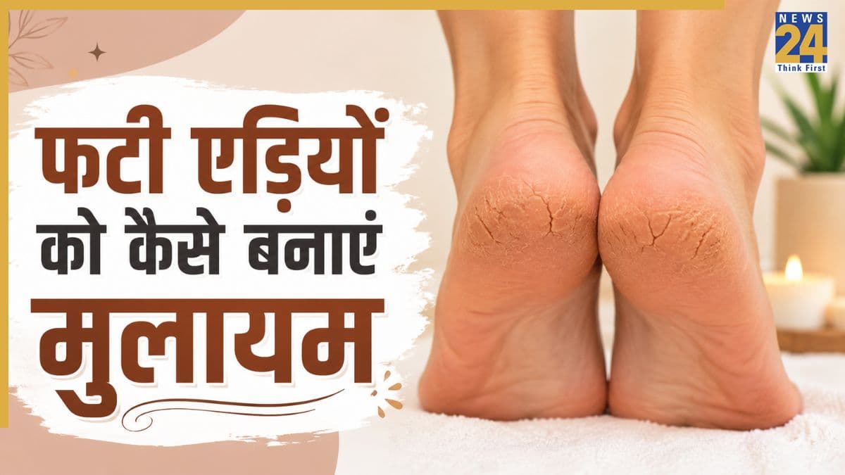 फटी एड़ी को मुलायम कैसे करें? जानिए रसोई की कौन सी चीजें पैरों को बनाएंगी सॉफ्ट
