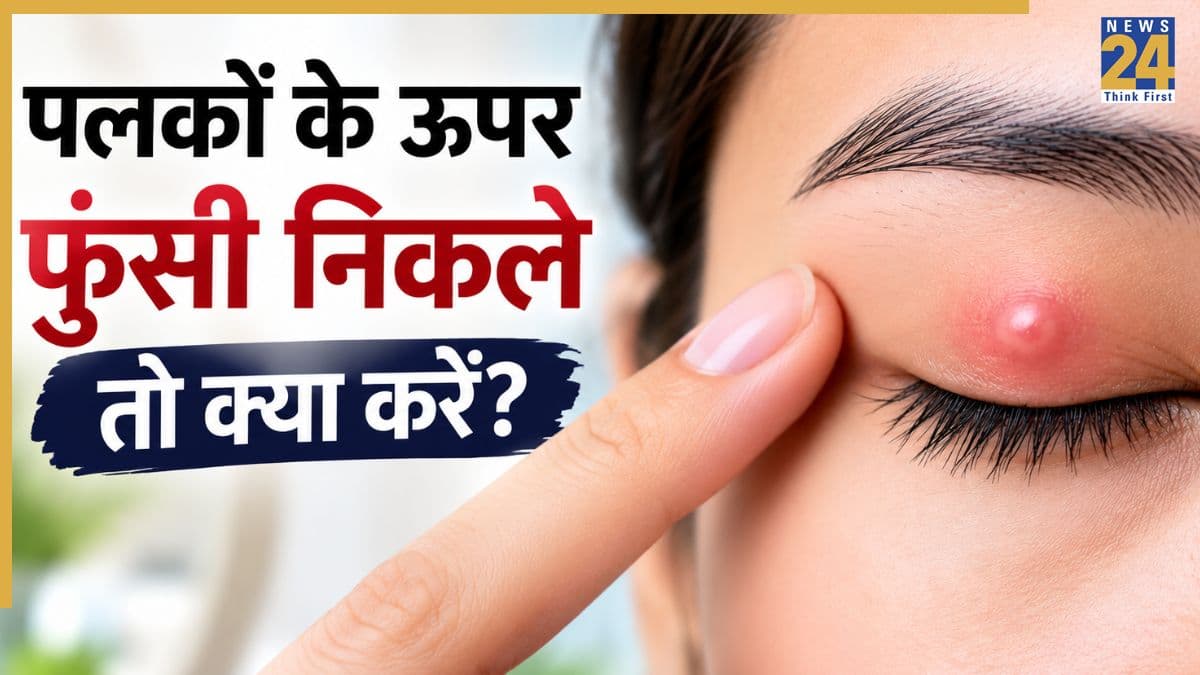 आंखों की पलक पर बार-बार क्यों निकलती है फुंसी? आई डॉक्टर ने बताई वजह, शेयर किए कुछ जरूरी टिप्स
