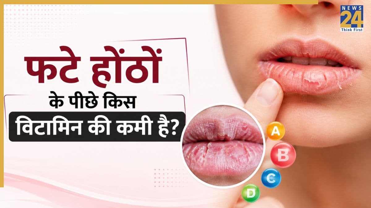 होंठ किस विटामिन की कमी से फटते हैं? जानिए Cracked Lips को कैसे बनाएं मुलायम