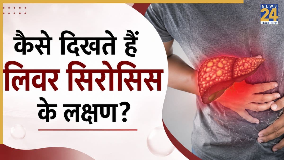 सालों तक चुपचाप बढ़ता है सिरोसिस, सामने आने तक डैमेज हो चुका होता है लिवर, डॉक्टर ने बताया समय रहते कैसे पहचानें लक्षण