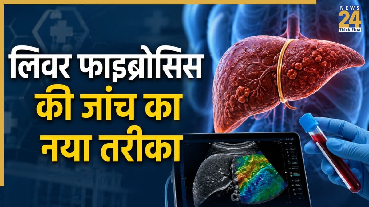 लिवर फाइब्रोसिस का बिना बायोप्सी के चलेगा पता, AIIMS के विशेषज्ञों नया खतरे का अंक किया तैयार, 189 मरीजों पर हुआ अध्ययन