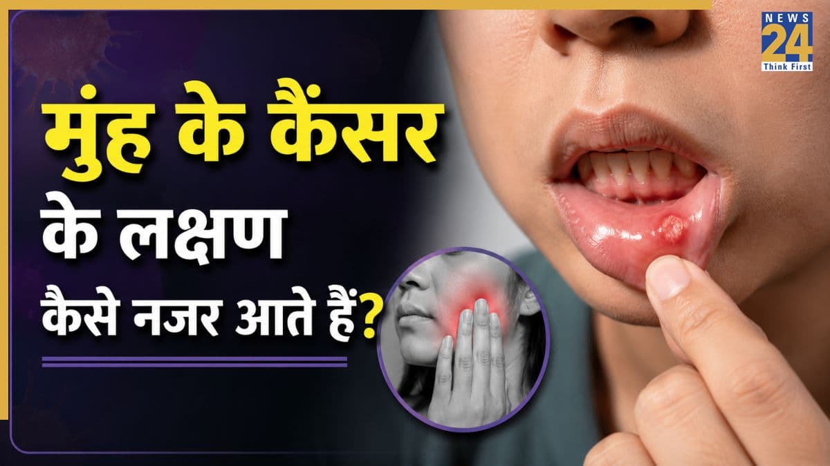 Oral Cancer Symptoms: मुंह में कैंसर होता है तो कैसे पता चलता है? स्वास्थ्य मंत्रालय ने बताए लक्षण और किन टेस्ट से होगा कंफर्म