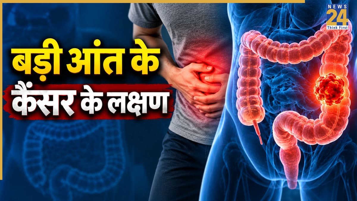 बड़ी आंत के कैंसर के क्या लक्षण होते हैं? ये 2 Symptoms दिखें तो तुरंत डॉक्टर से मिलना है जरूरी
