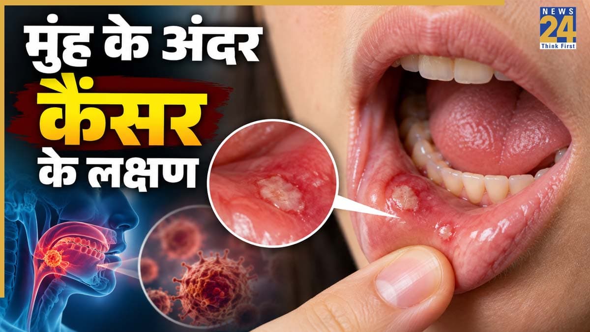 मुंह में कैंसर का पता कैसे चलता है? जानिए जीभ, होंठ या मसूड़ों पर कैसे नजर आते हैं Oral Cancer के लक्षण